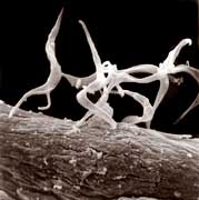 Trypanosoma cruzi